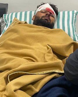 Rishabh Pant Injured in Car Accident, Distressing Picture Surfaces on Internet 2